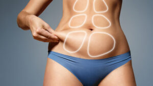 τοπικο αδυνατισμα